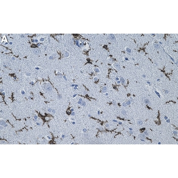 Anti-P2RY12 Antibody, clone 2C12 ZooMAb® Rabbit Monoclonal，4X25UL，ZRB1236-4X25UL，Sigma