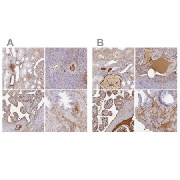 Anti-ALB antibody produced in rabbit，100UL，HPA031025-100UL，Sigma