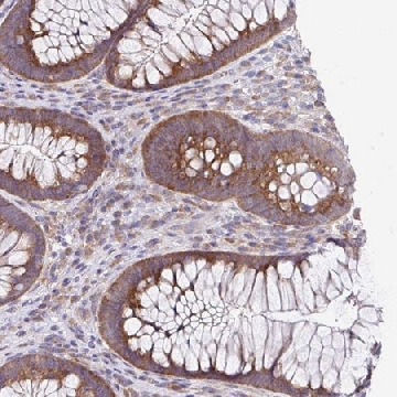 Anti-EIF4B antibody produced in rabbit，100UL，HPA046164-100UL，Sigma