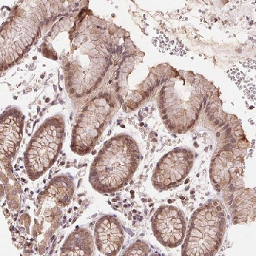 Anti-BTF3L4 antibody produced in rabbit，100UL，HPA067026-100UL，Sigma