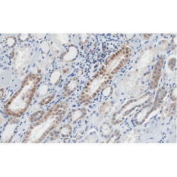 Anti-STAT1 (isoform alpha) Antibody, clone 1D4 ZooMAb® Rabbit Monoclonal，25UL，ZRB1459-25UL，Sigma