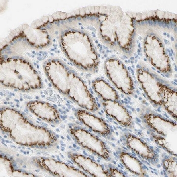 Anti-GALNT5 antibody produced in rabbit，100UL，HPA008963-100UL，Sigma