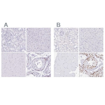 抗-CXorf67 兔抗，100UL，HPA004003-100UL，Sigma