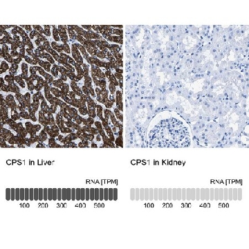 Anti-CPS1 antibody produced in rabbit，100UL，HPA021400-100UL，Sigma
