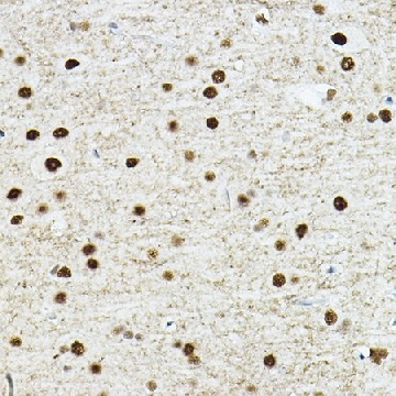 Anti-TEAD1 antibody produced in rabbit，100UL，SAB5701052-100UL，Sigma