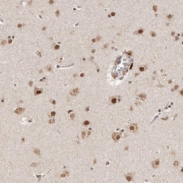 Anti-GLTSCR1L antibody produced in rabbit，100UL，HPA029391-100UL，Sigma