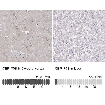 Anti-CEP170B antibody produced in rabbit，100UL，HPA059017-100UL，Sigma