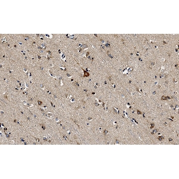 Anti-PKCα Antibody, clone 2H22 ZooMAb® Rabbit Monoclonal，4X25UL，ZRB1594-4X25UL，Sigma