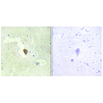 Anti-ADCY7 antibody produced in rabbit，100UG，SAB4500247-100UG，Sigma