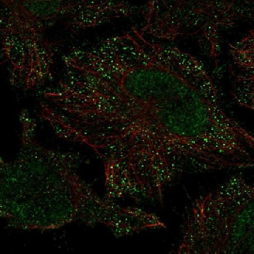 Anti-PIEZO2 antibody produced in rabbit，100UL，HPA031975-100UL，Sigma
