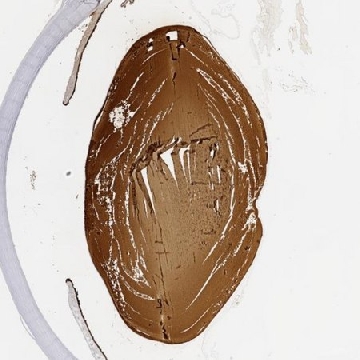 Anti-CRYBB2 antibody produced in rabbit，100UL，HPA043749-100UL，Sigma