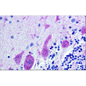 Anti-ST18，100UL，SAB2108720-100UL，Sigma