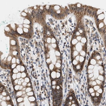 Anti-GIGYF1 antibody produced in rabbit，100UL，HPA020999-100UL，Sigma