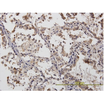Monoclonal Anti-ACTN4 antibody produced in mouse，100UG，WH0000081M1-100UG，Sigma