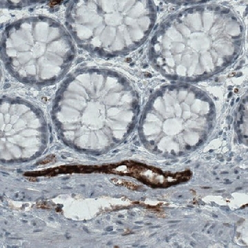 Monoclonal Anti-VWF antibody produced in mouse，100UL，AMAB90931-100UL，Sigma