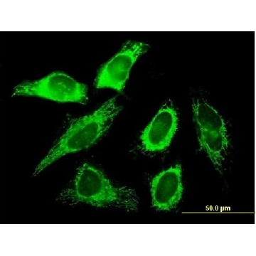 Anti-SLC25A3 antibody produced in mouse，50UG，SAB1400208-50UG，Sigma