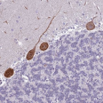 Anti-PPP1R17 antibody produced in rabbit，100UL，HPA047819-100UL，Sigma