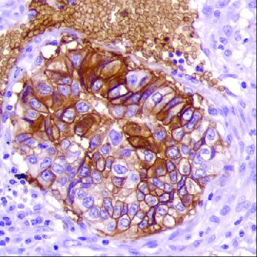 Anti-GLUT-1 antibody, Rabbit monoclonal，100UL，SAB5500114-100UL，Sigma
