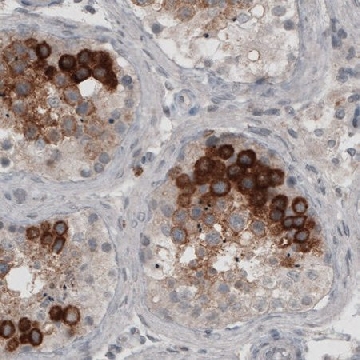 Monoclonal Anti-LY6K antibody produced in mouse，100UL，AMAB90987-100UL，Sigma