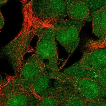 Anti-C19Orf67 Antibody Produced In Rabbit，1004G，HPA046351-100UL，Sigma