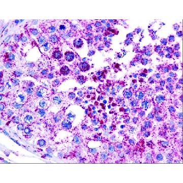 Anti-MAGEA3 antibody produced in rabbit，100UL，SAB2101419-100UL，Sigma