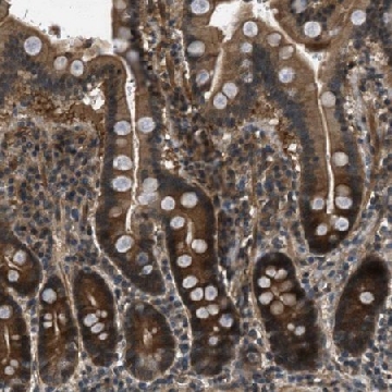 Anti-EPSTI1 antibody produced in rabbit，100UL，HPA017362-100UL，Sigma