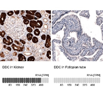 Monoclonal Anti-DDC antibody produced in mouse，100UL，AMAB91089-100UL，Sigma