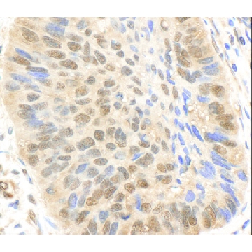 Rabbit anti-p300 Antibody, Affinity Purified，100UL，PLA0096-100UL，Sigma