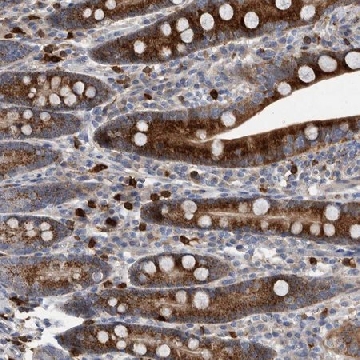 Anti-CRISPLD2 antibody produced in rabbit，100UL，HPA030055-100UL，Sigma