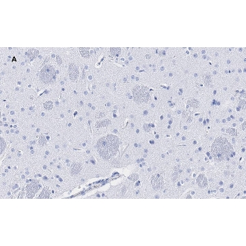 Anti-Tyrosine Hydroxylase Antibody, clone 3M12, ZooMAb® Rabbit Monoclonal，4X25UL，ZRB2381-4X25UL，Sigma