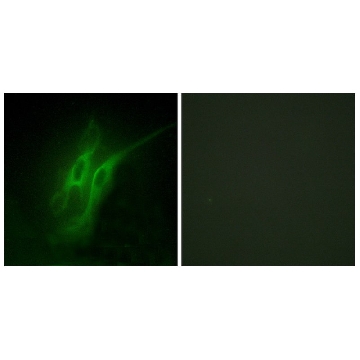 Anti-5-HT-4 antibody produced in rabbit，100UG，SAB4501480-100UG，Sigma