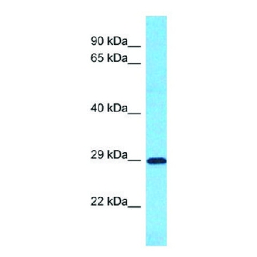 Anti-SLC25A35 antibody produced in rabbit，100UL，SAB2109047-100UL，Sigma