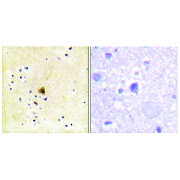 Anti-RYR2 antibody produced in rabbit，100UG，SAB4502707-100UG，Sigma