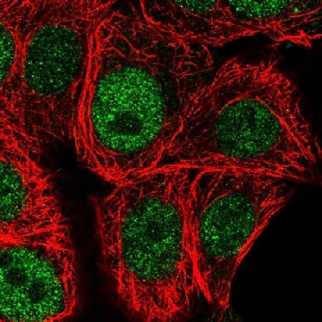 Anti-CHEK1 antibody produced in rabbit，100UL，HPA044364-100UL，Sigma