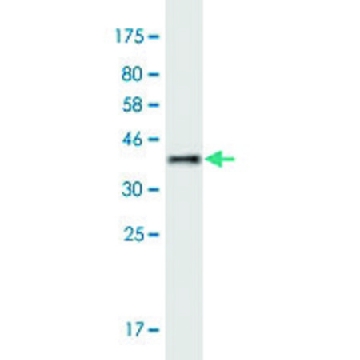 Monoclonal Anti-MYLK4 antibody produced in mouse，100UG，SAB1412951-100UG，Sigma