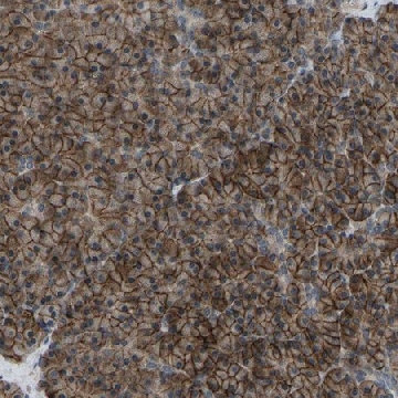 Anti-SLC43A1 antibody produced in rabbit，100UL，HPA018813-100UL，Sigma