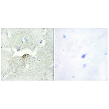 Anti-LMTK2 antibody produced in rabbit，100UG，SAB4500900-100UG，Sigma