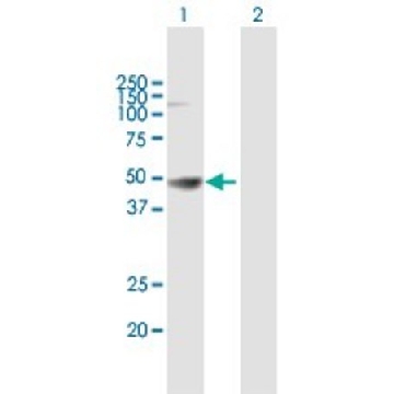 Anti-HLA-A antibody produced in mouse，50UG，SAB1405936-50UG，Sigma