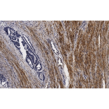 Anti-Vinculin Antibody, clone 3M13 ZooMAb® Rabbit Monoclonal，4X25UL，ZRB1089-4X25UL，Sigma