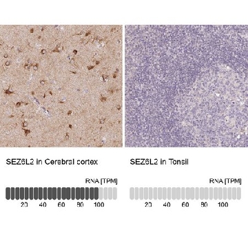 Anti-SEZ6L2 antibody produced in rabbit，100UL，HPA064471-100UL，Sigma