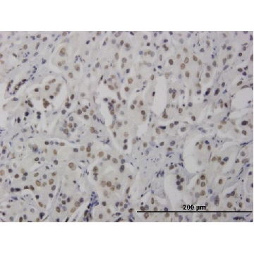 Monoclonal Anti-RNF168 antibody produced in mouse，100UG，WH0165918M1-100UG，Sigma