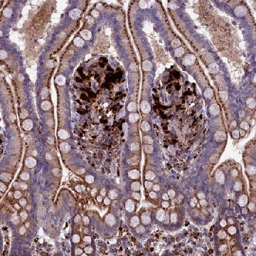 Anti-MAN2B1 antibody produced in rabbit，100UL，HPA041530-100UL，Sigma