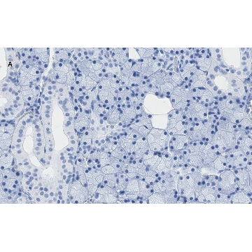 Anti-TMEM16A Antibody, clone 3J18, ZooMAb® Rabbit Monoclonal，25UL，ZRB1171-25UL，Sigma