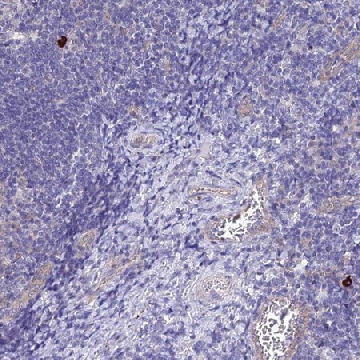 Anti-APOBEC3H antibody produced in rabbit，100UL，HPA021492-100UL，Sigma