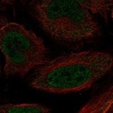 Anti-MEOX1 antibody produced in rabbit，100UL，HPA063788-100UL，Sigma