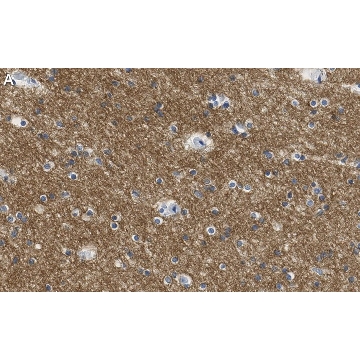 Anti-KCNQ2 Antibody, clone 2G18 ZooMAb® Rabbit Monoclonal，25UL，ZRB1299-25UL，Sigma