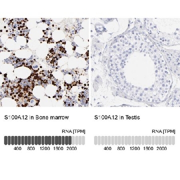 Anti-S100A12 antibody produced in rabbit，100UL，HPA002881-100UL，Sigma