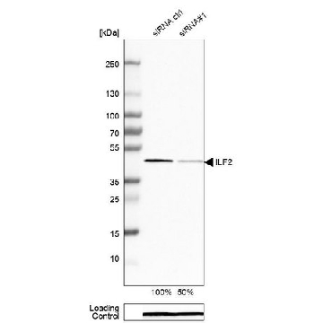 Anti-ILF2 antibody produced in rabbit，100UL，HPA007484-100UL，Sigma