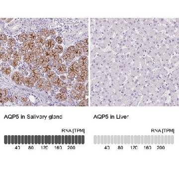 Anti-AQP5 antibody produced in rabbit，100UL，HPA065008-100UL，Sigma