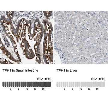 Anti-TPH1 antibody produced in rabbit，100UL，HPA022483-100UL，Sigma